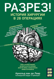 Аудиокнига Разрез! История хирургии в 28 операциях